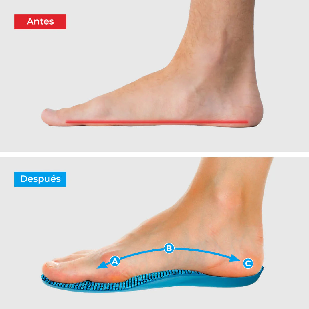 2x1 Plantillas ComfyFeet - Disfruta de días sin dolor | Ortopédicas Profesional.