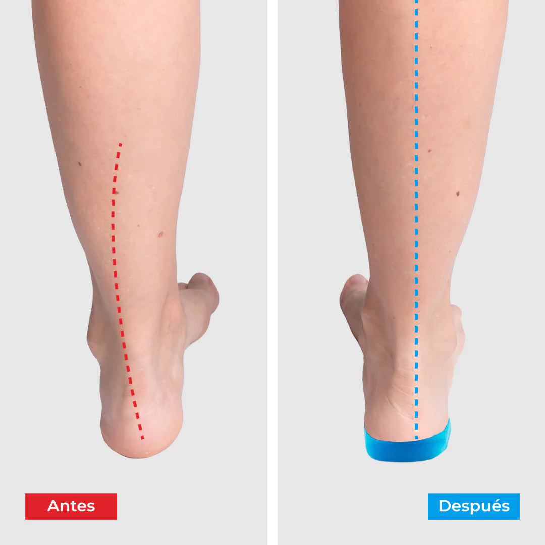 2x1 Plantillas ComfyFeet - Disfruta de días sin dolor | Ortopédicas Profesional.